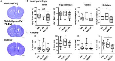 Mesenchymal Stromal Cell-Derived Extracellular Vesicles Reduce Neuroinflammation, Promote Neural Cell Proliferation and Improve Oligodendrocyte Maturation in Neonatal Hypoxic-Ischemic Brain Injury